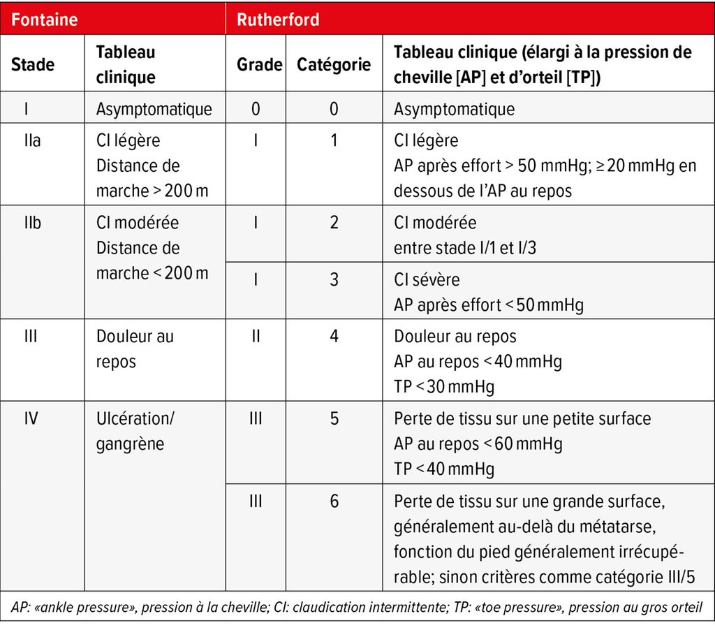 l-infarctus-d-bute-au-niveau-de-la-jambe-aper-u-du-pronostic-de-l